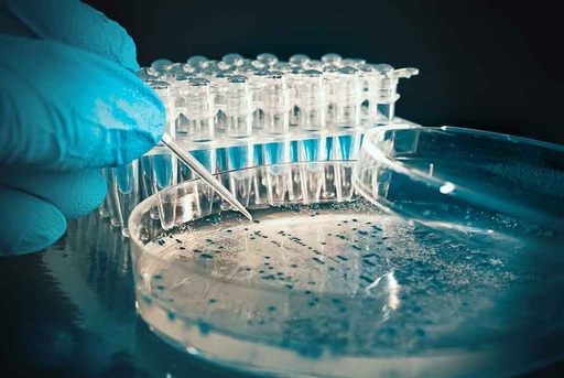 [346-ER-0233-01] RT PCR Kit for detection of Bunyavirus
